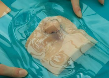 Al Meyer di Firenze ricostruito il nasino ad un bambino: il modello stampato in 3d della scansione del volto del bambino. 📸 dire.it
