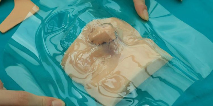 Al Meyer di Firenze ricostruito il nasino ad un bambino: il modello stampato in 3d della scansione del volto del bambino. 📸 dire.it